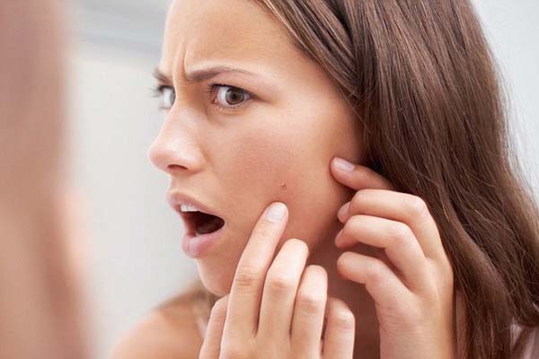 how to get rid from pimple